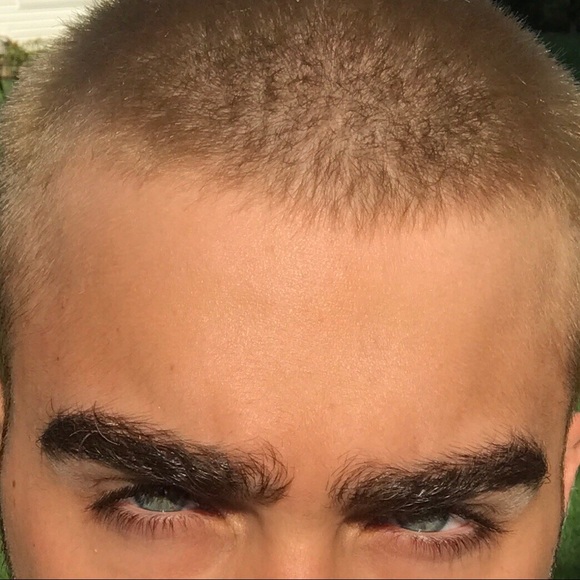 benalessi